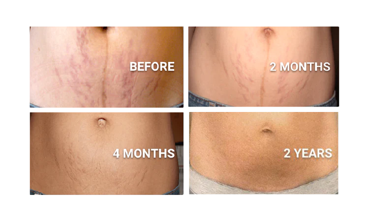 Palmer's Cocoa Butter Formula Massage Cr